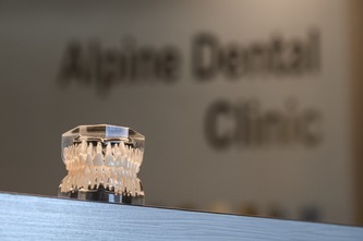 model of teeth at alpine dental clinic