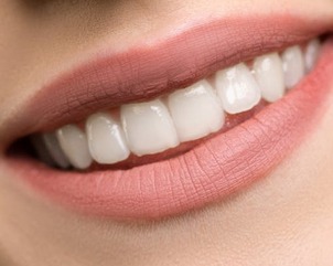 teeth with dental bonding