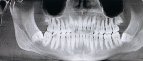 dentist x-ray of patient