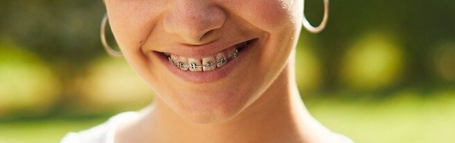 Girl with orthodontic braces on her teeth smiling