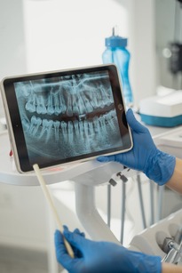 teeth grinding x-ray on a tablet