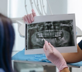 Patient Teeth x-ray patient x-ray of mouth